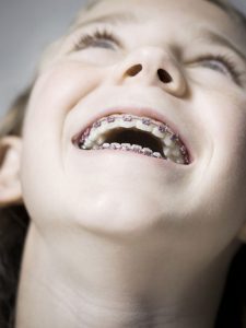 orthodontist limburg echt susteren