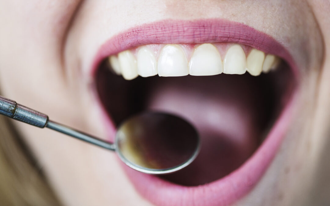 Waarom een gezonde mond belangrijk is voor je algehele gezondheid