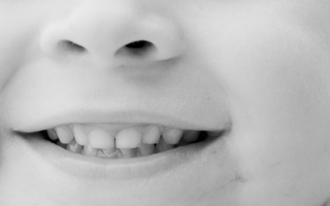 Tanden wisselen bij kinderen